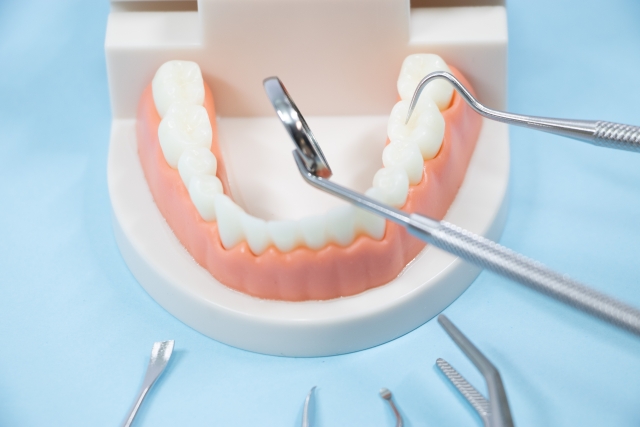 歯の食いしばりが招く偏頭痛!~顎から全身へ広がる痛みの連鎖~